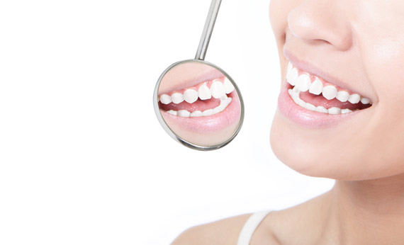 Dental Implants Costa Mesa