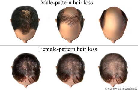 Hair Loss and Scalp Clinic