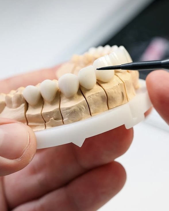 Porcelain Veneers Sydney