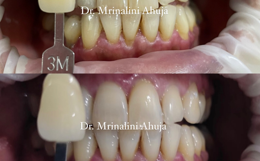 Dr. Mrinalini Ahuja | Best Dentist In Delhi | Cosmetic Dentistry  &hellip;