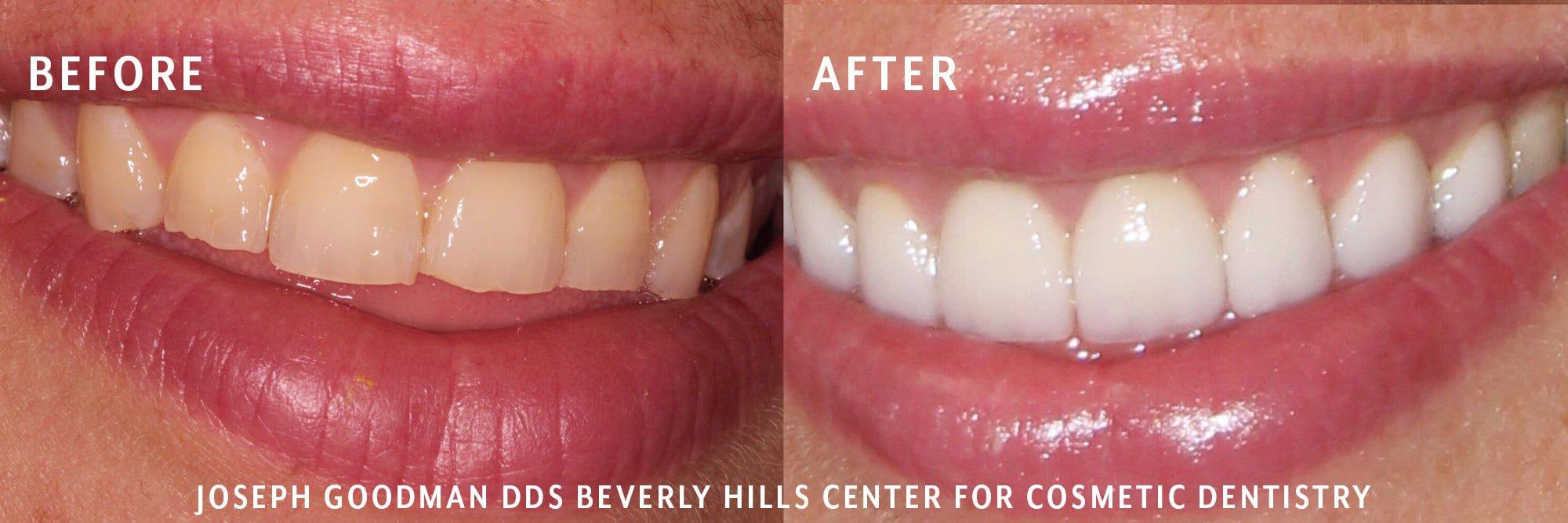 Dr. Joseph Goodman | Beverly Hills Dentist