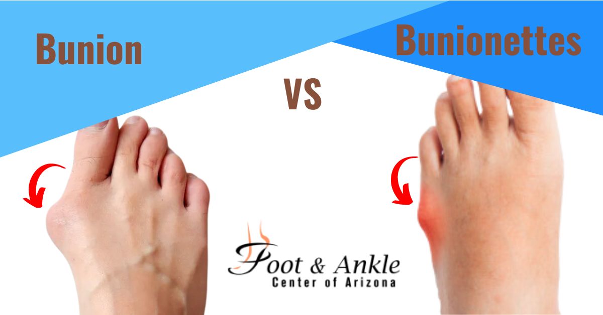 Foot and Ankle Center of Arizona | Kris A. DiNucci, DPM, FACFAS