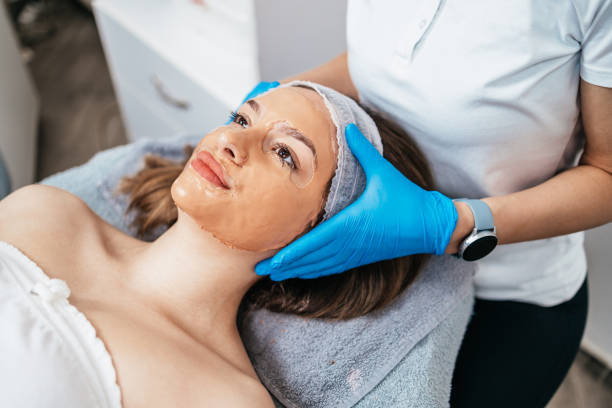 chemical skin peel treatment in Islamabad