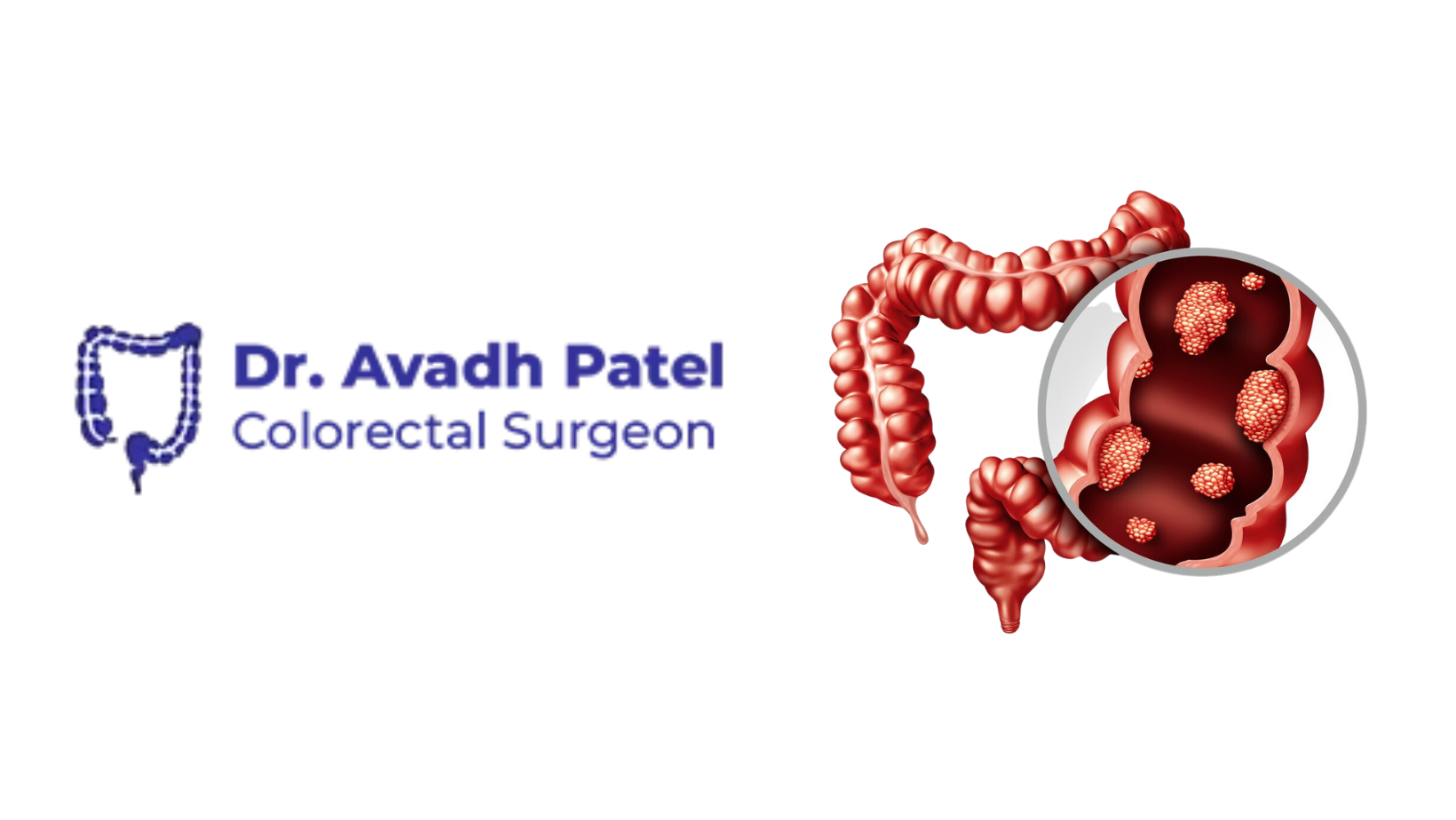 Dr. Avadh Patel