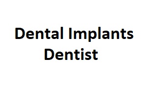 Dental Implants Dentist