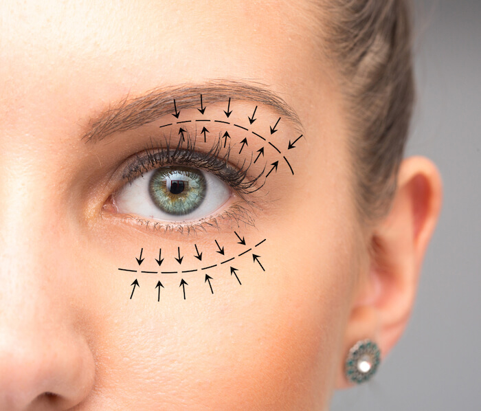 Eyes Defined | Ophthalmologist london | Cataract surgery
