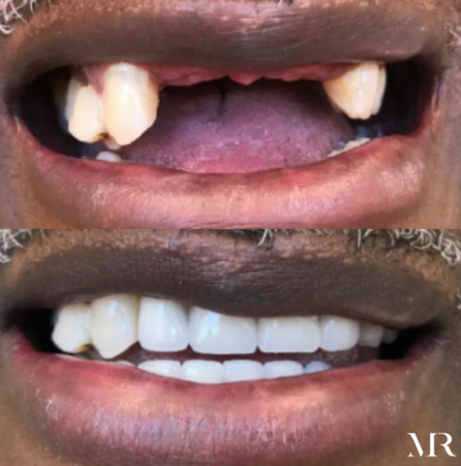 MR Dental Aesthetics