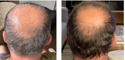 Micellar Haircare