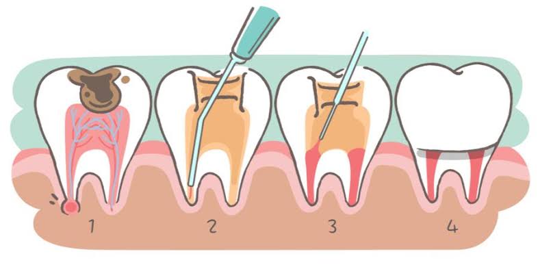 Smile 4 Me Dental