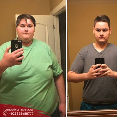Weight Loss treatments in Islamabad