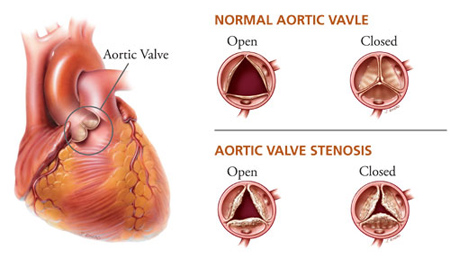Dr. Ravinder Singh Rao is a Chief Interventional Cardiologist for &hellip;