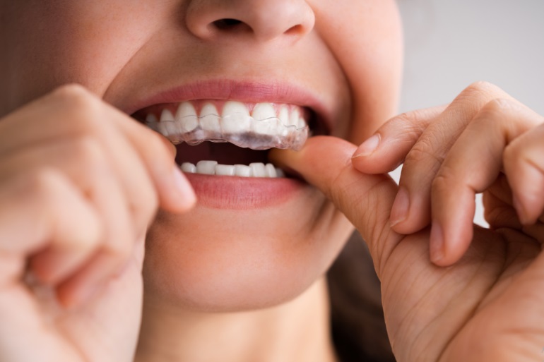 Arka Dental Care – Raidurg/Gachibowli