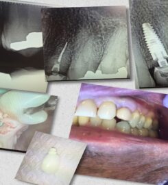 Central Valley Dentistry & Implants