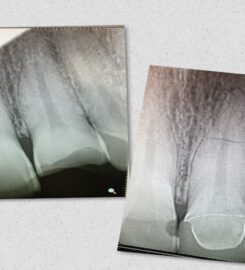Central Valley Dentistry & Implants