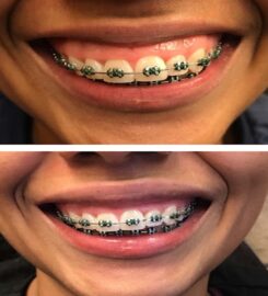 Central Valley Dentistry & Implants