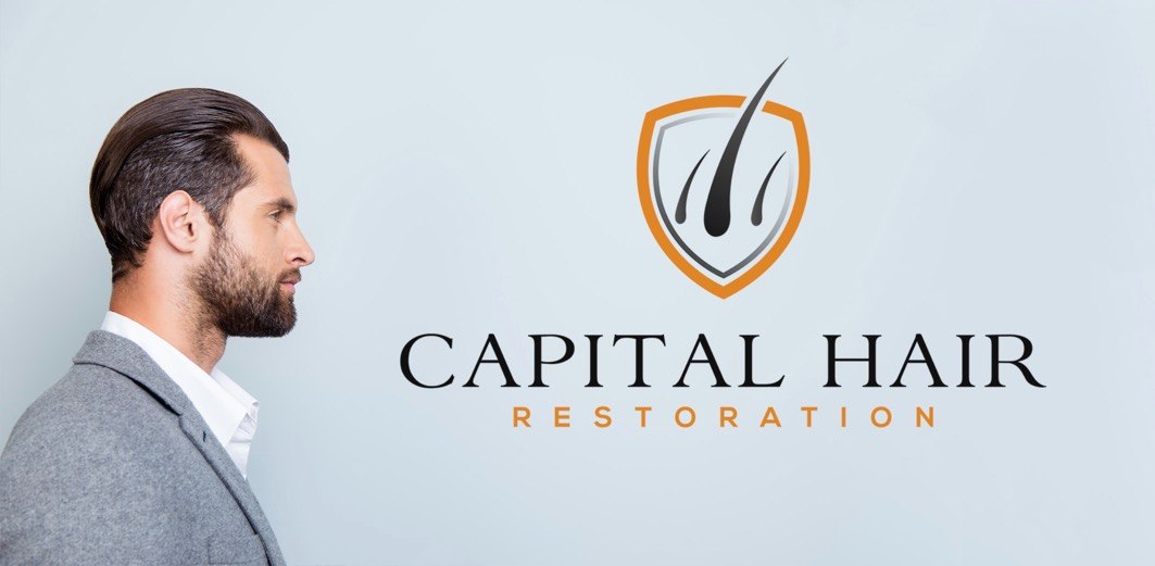 Capital Hair Restoration – Hair Transplant