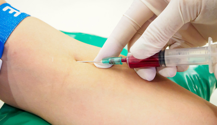 Affordable Blood Tests at Home