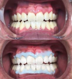 Dr Kamila Houston Dentist | Houston Cosmetic and Holistic Dentist