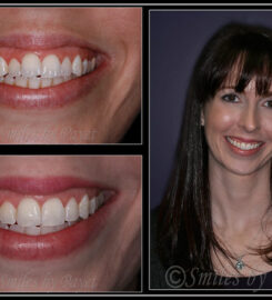 Smiles by Payet Dentistry