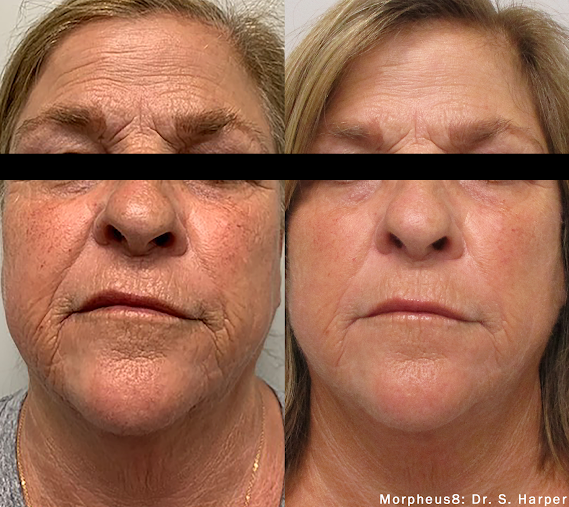 Anti Aging and Ketamine Center