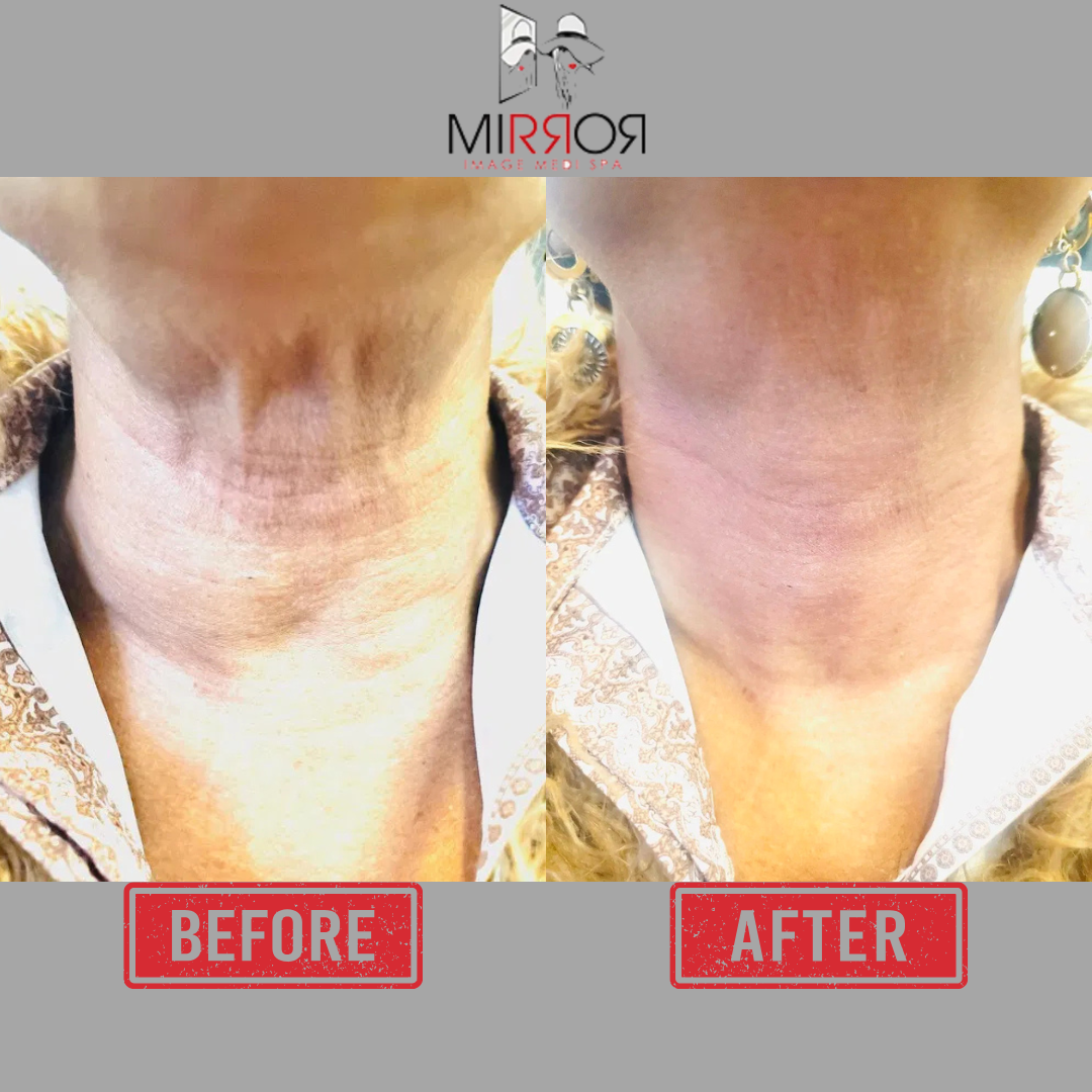 Mirror Image Medi Spa