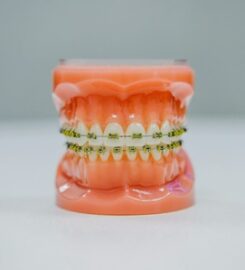 Zubní implantáty Brno