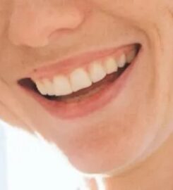Dental Excellence of Hatfield