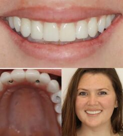 4M Dental Implant Center