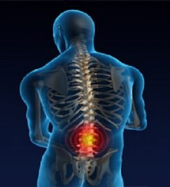 Living Well Chiropractic Center