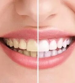 Randhawa Dentistry