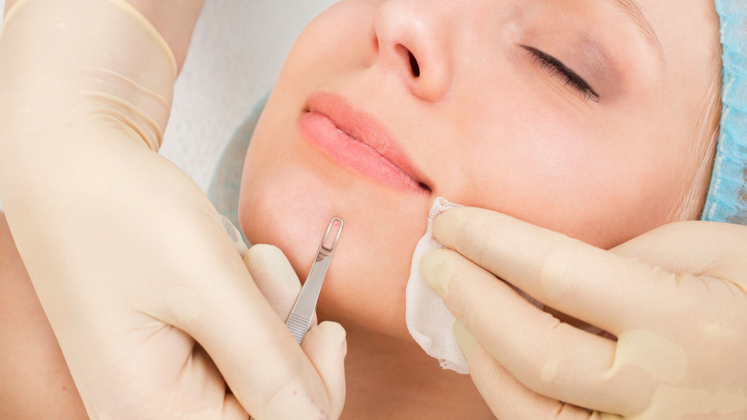 Deep Cleansing Facial in Dubai