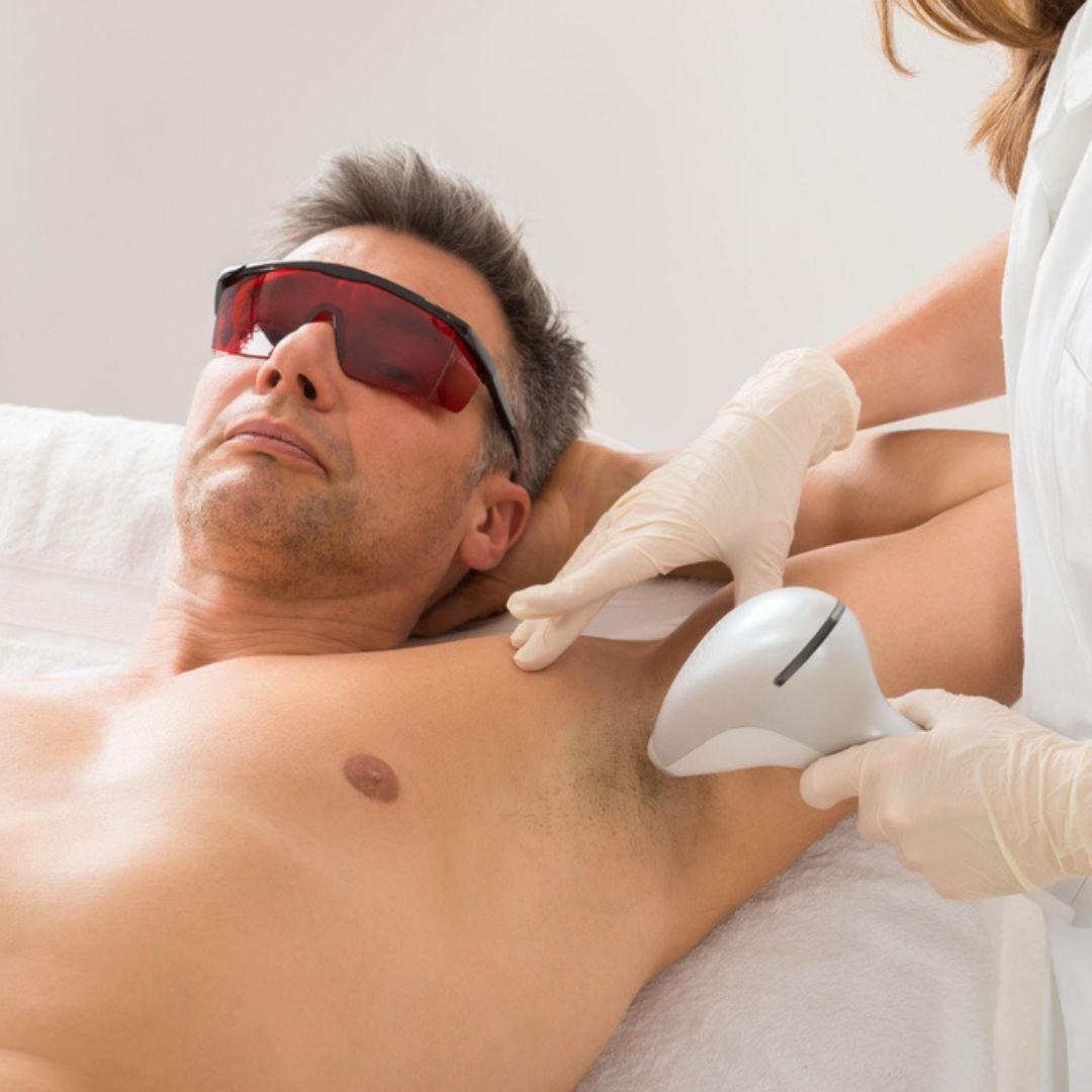 Male Laser Hair Removal Cost in Dubai