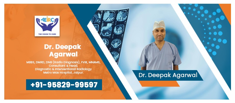 Varicocele Treatment in Jaipur | AEIRC