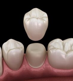 Bethany Family Dental Portland