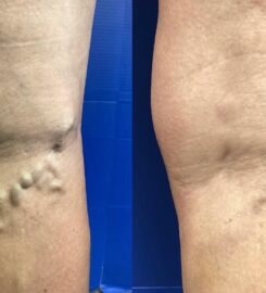 Northern Michigan Vein Specialists