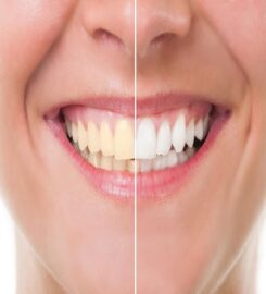 Sky Dental