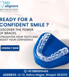 M3 Aligners