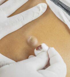 Bernard Lim Specialist Surgery Pte. Ltd.