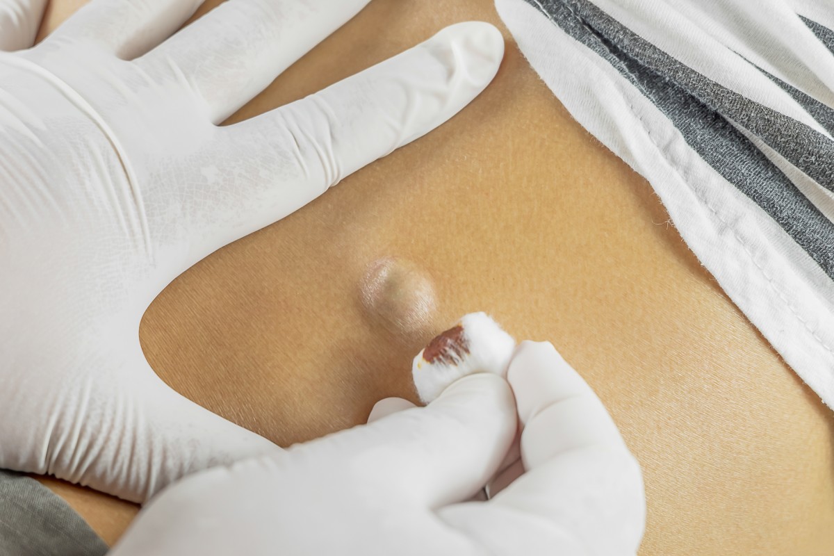 Bernard Lim Specialist Surgery Pte. Ltd.