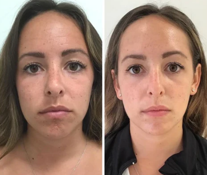 Medical Skin health