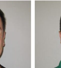Weight loss Valley medical