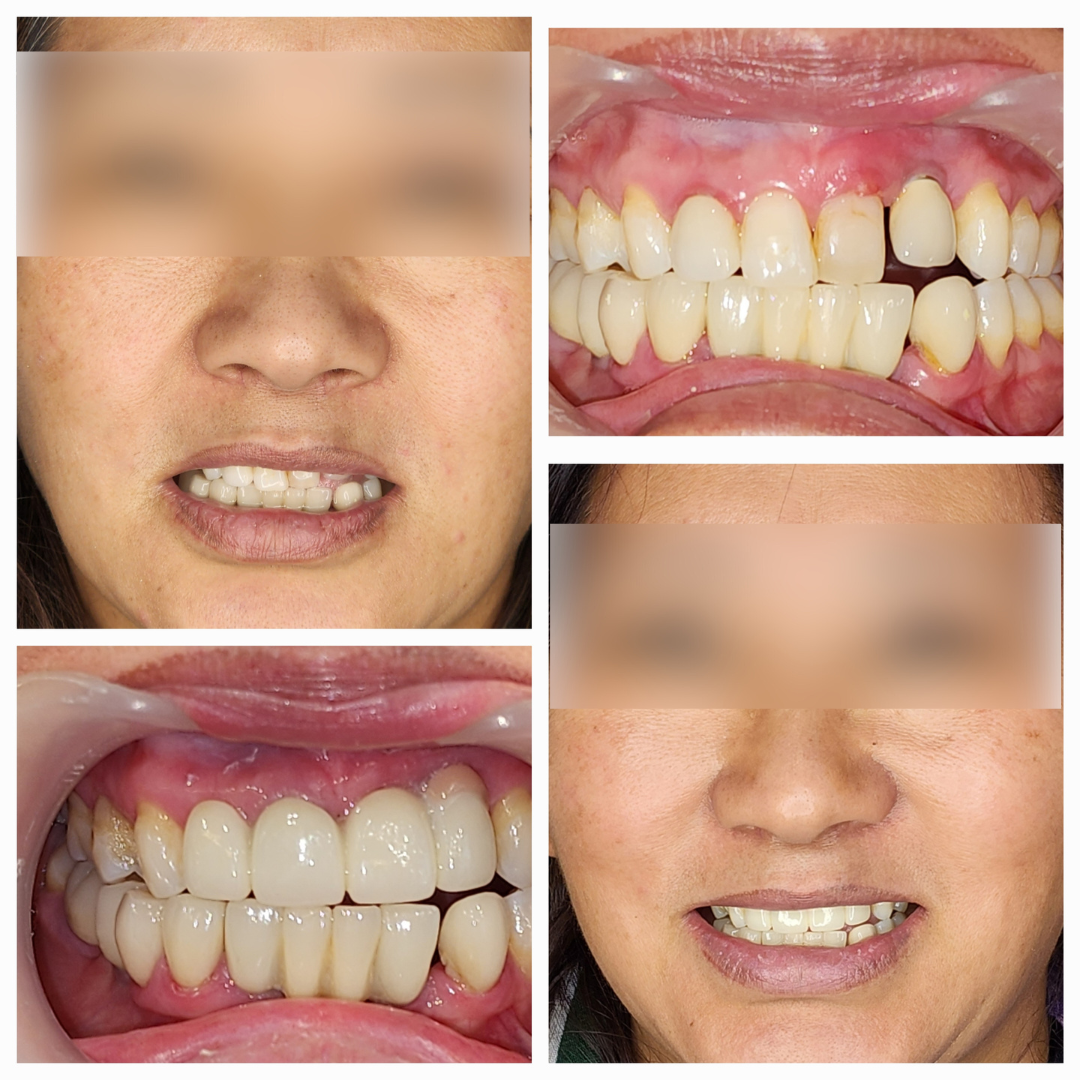 DR BHUTANI DENTAL CLINIC