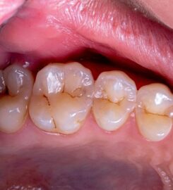 The Endodontic Office