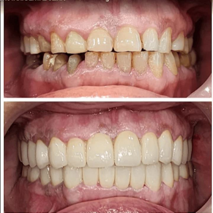 DR BHUTANI DENTAL CLINIC