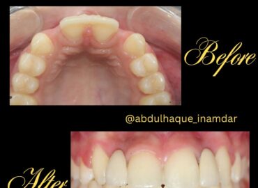 Dr. Inamdar Dental Speciality Clinic | Dr Abdul Haque Inamdar