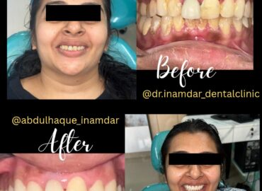 Dr. Inamdar Dental Speciality Clinic | Dr Abdul Haque Inamdar
