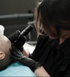 THE BLACK LIGHT — Scalp Micropigmentation (SMP)