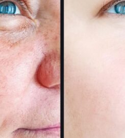 Distill Laser Clinic