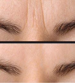 Distill Laser Clinic
