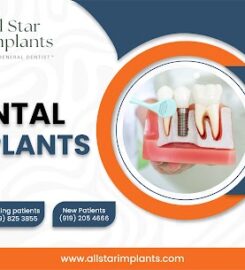 All Star Implants
